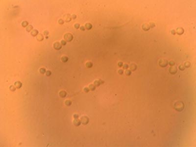 Spores
