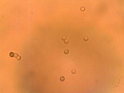 Spores