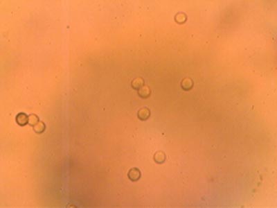 Spores
