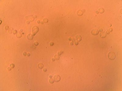 Spores