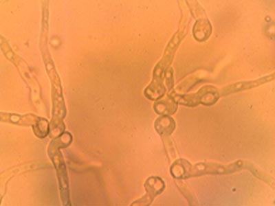 Spores