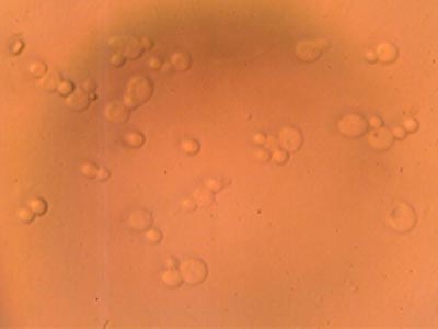 Spores