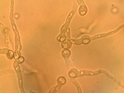 Spores