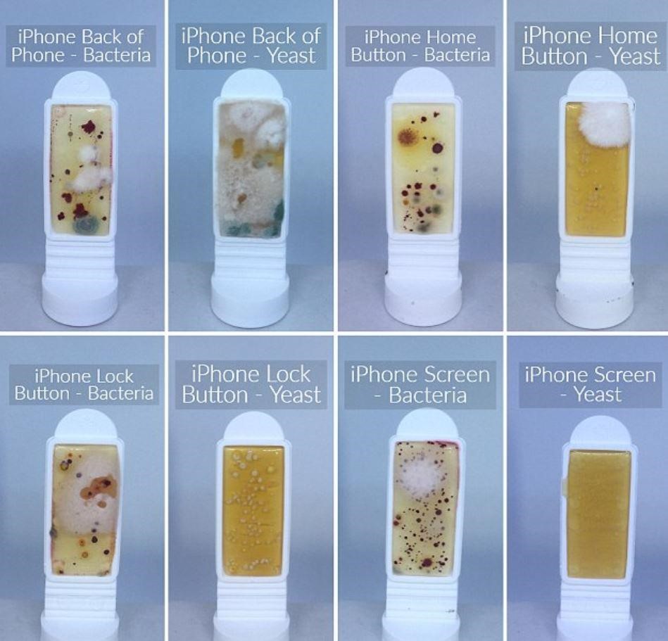 Yeast and Bacteria Presence on iPhone Test