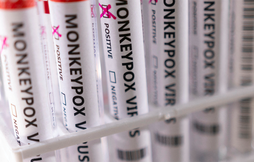 Monkey Pox in Singapore